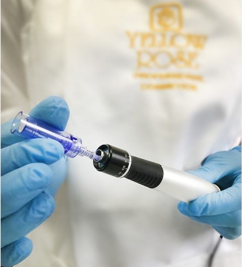 microneedling